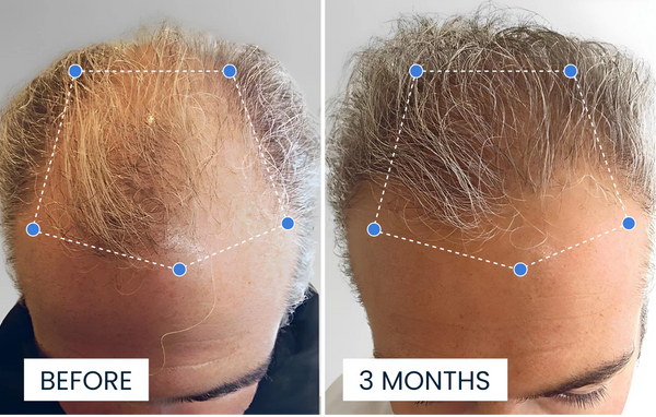 Kundresultat före och efter