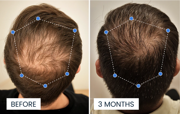Kundresultat före och efter